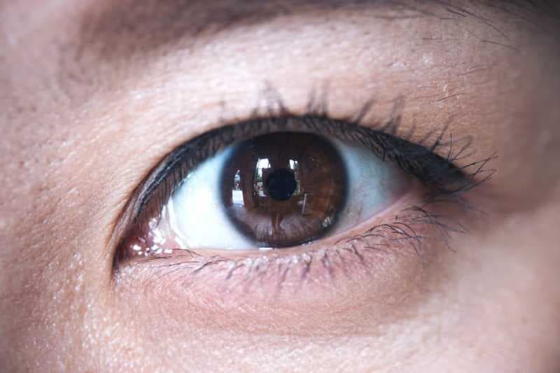 Mata Anda Juga Bisa Kena Stroke! Apa Penyebabnya?